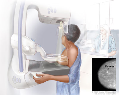 Breast Cancer Screening and Breast Pain Treatment in Borivali